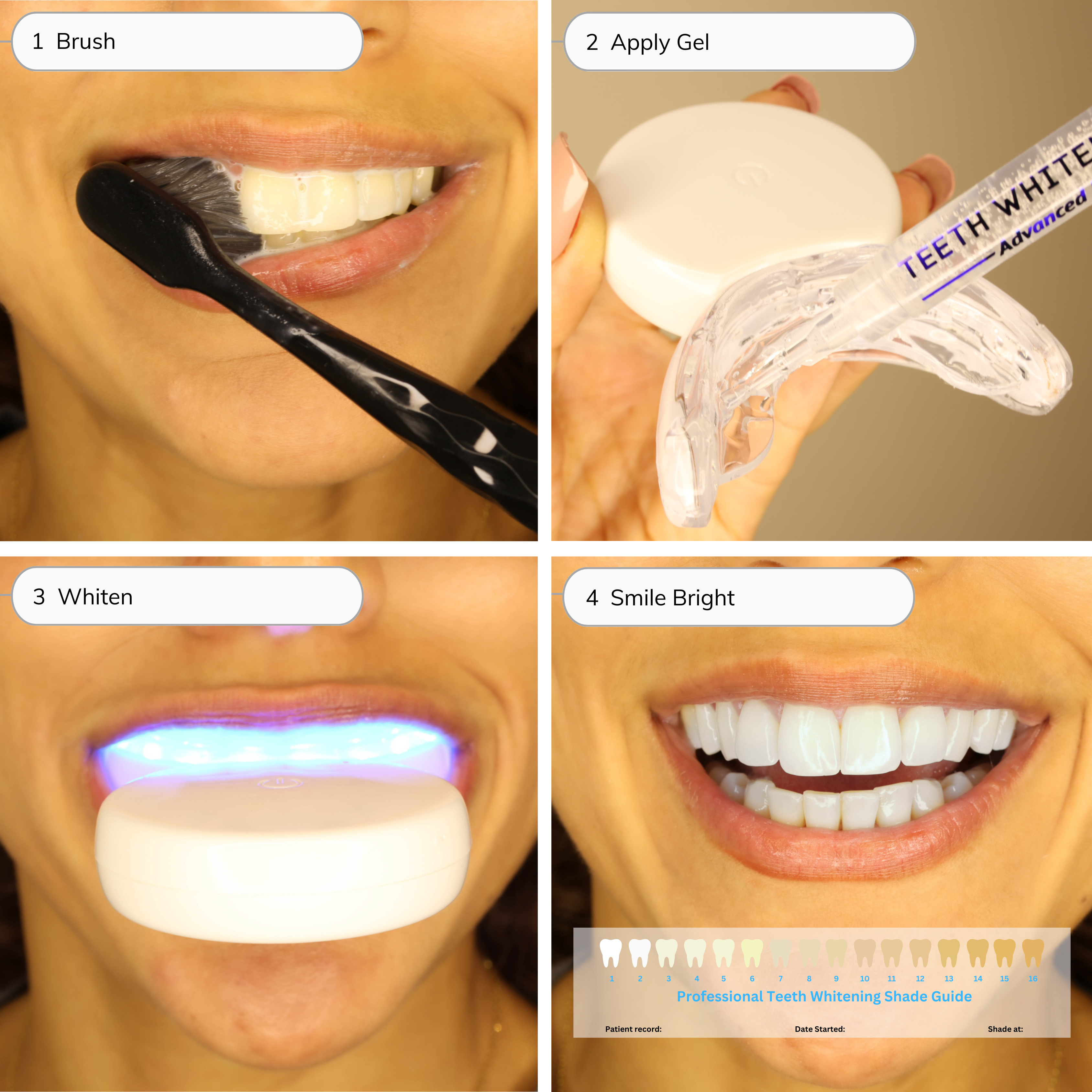 🔥Last Day Sale - 50% OFF🎁 Comprehensive Teeth Whitening Kit with