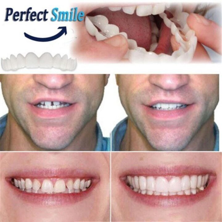 💥 Last three hours 50% off 💥Latest 👨‍⚕ Hospital Adjustable Treatment Dentures