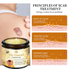 BENDCHARGE™ Bee Essence Skin Treatment Cream (AAD Recommended👨‍⚕️)
