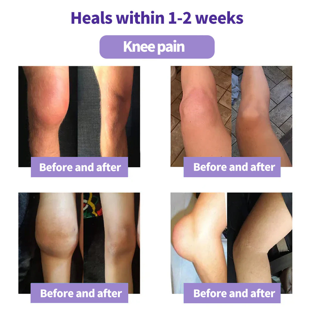 🔥Turmeric & Emu Oil Arthritis Soothing Pain Relief Massage Gel 👨‍⚕️Australian Osteopathic Association （AOA）Approved