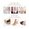 🔥Mother's Day Sale 70% OFF- Adjustable Toe Filler Inserts