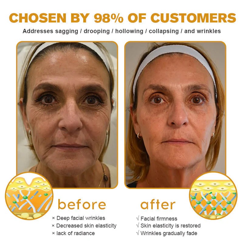 🔥Last Day Discount: 70% OFF - Upgraded Instant Wrinkle Eye Tightener cream