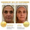 🔥Last Day Discount: 70% OFF - Upgraded Instant Wrinkle Eye Tightener cream