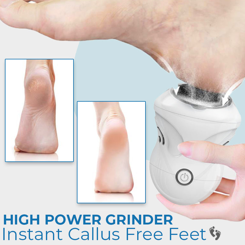 🎄CHRISTMAS SALE 70% OFF🎄Electric Portable Vacuum Foot Grinder