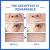 Last Day Promotion 49% OFF--2023 New Collagen Boost Anti-Aging Serum