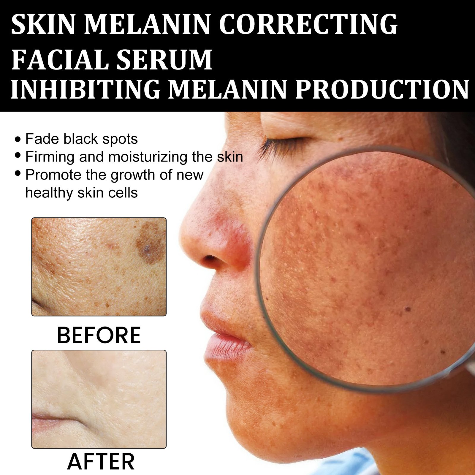 🔥Last Day Promotion 48% OFF-🎁-Melanin Correcting Facial Serum