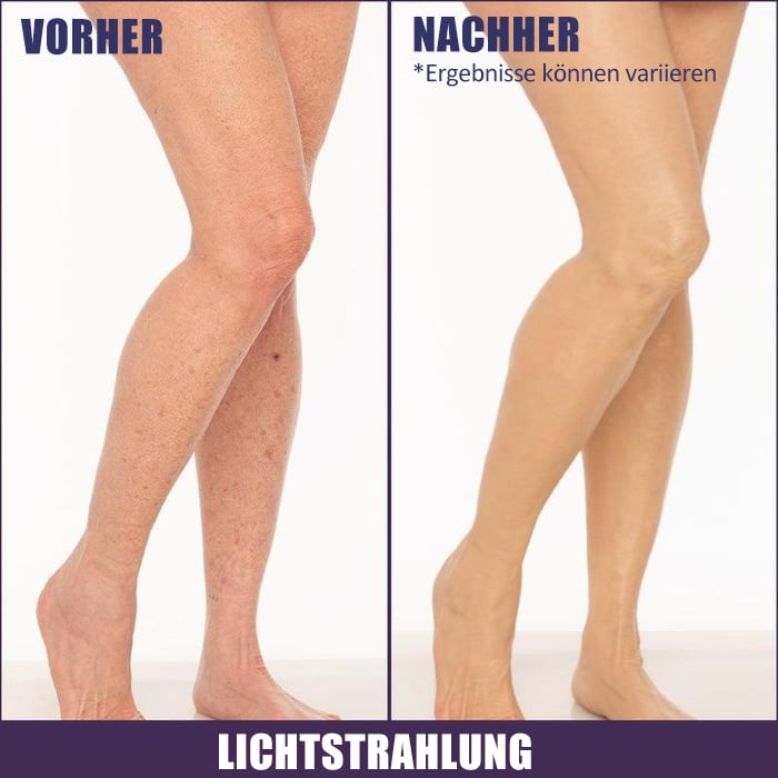 ✨Concealer – 3 in 1Body Coverage Perfector 💧 Leicht und wasserfest