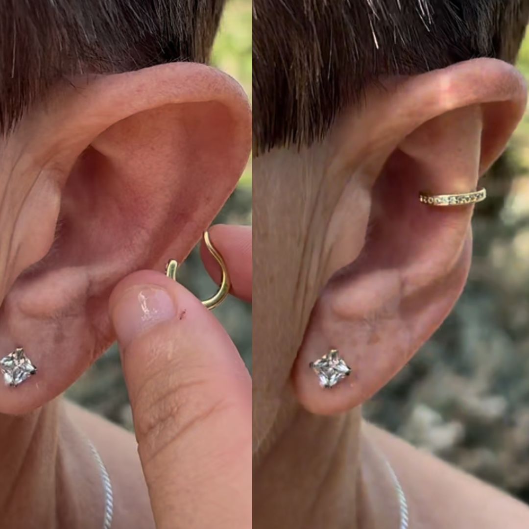 🔥Last Day Promotion 70% OFF🔥925 Silver - Aesthetic Ear Correction without Surgery