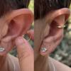🔥Last Day Promotion 70% OFF🔥925 Silver - Aesthetic Ear Correction without Surgery
