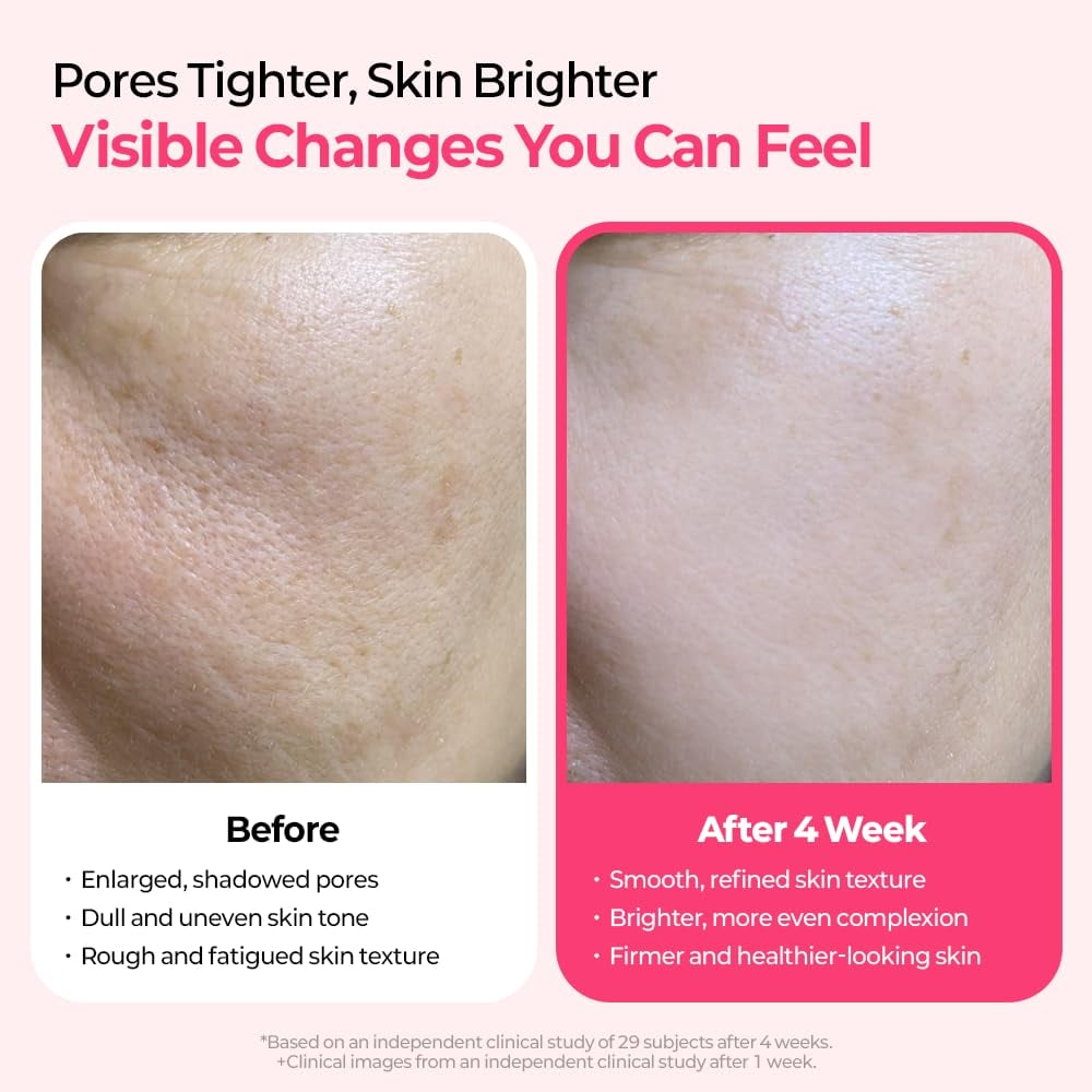 🔥LAST DAY SALE 50% OFF🔥Pore & Spot Care Duo