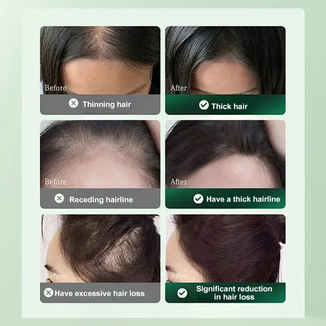 ANTI-HAIR LOSS AND HAIR GROWTH SOLUTION