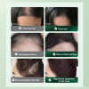 ANTI-HAIR LOSS AND HAIR GROWTH SOLUTION