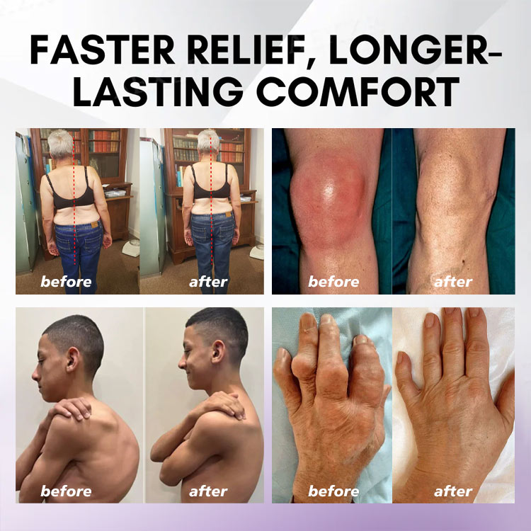 🔥Turmeric & Emu Oil Arthritis Soothing Pain Relief Massage Gel 👨‍⚕️Australian Osteopathic Association （AOA）Approved