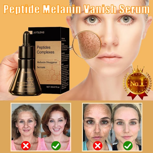 (🔥Daily Sales of 6000+🔥) - 2024 Hot Sale Whitening Skin Melanin Correcting Facial Serum [BUY 1 GET 1 FREE]