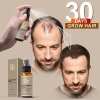 💥2023 New Hair Growth Spray - Fast Hair Growth - Prevent Hair Loss【🔥Buy 1 Get 1 Free🔥】