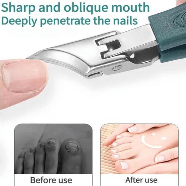🔥Last Day 49%🔥Eagle Beak Angled Nail Clippers 3-Piece Set