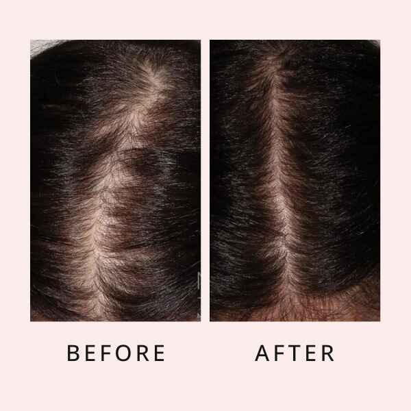 🔥Last Day Promotion 50% OFF🔥Hair Growth Serum