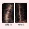 🔥Last Day Promotion 50% OFF🔥Hair Growth Serum