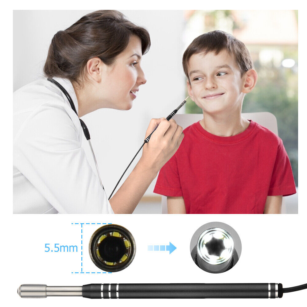 (🌲Early Christmas Sale- SAVE 48% OFF)3 In 1 Ear Cleaner Digital Otoscope(BUY 2 GET 1 FREE NOW)