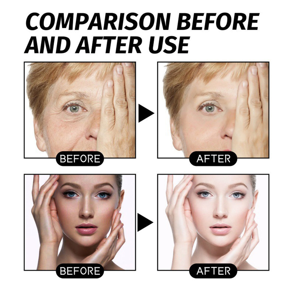 Sale Happening Now:ANTI-WRINKLE SKINCARE SET Eye Cream + Neck Cream-Perfect Duo