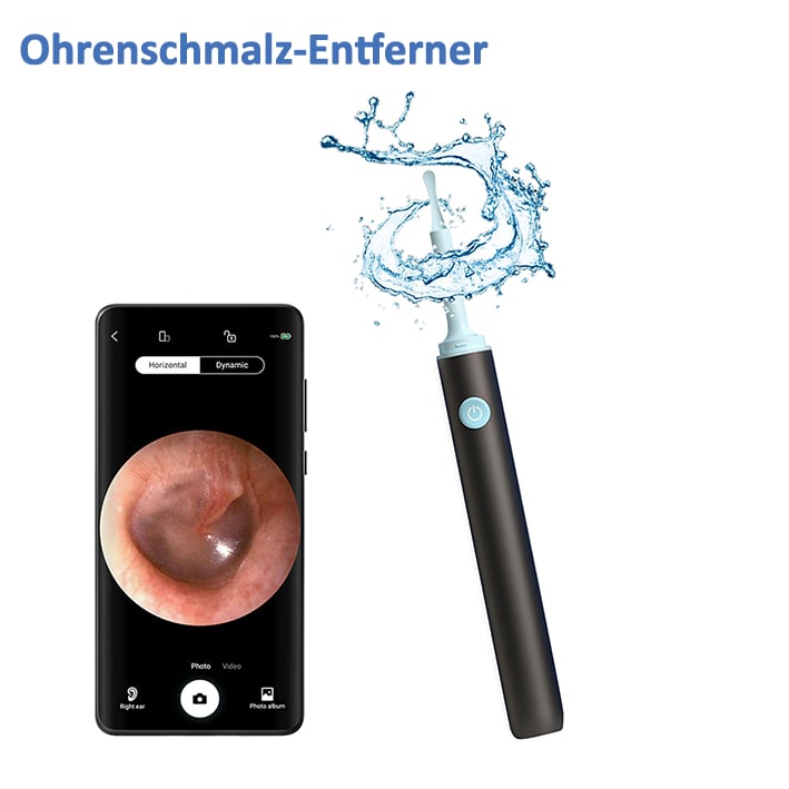 Ohrschmalz-Entfernungsset mit HD-Kamera