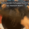🔥 Waschfreie Kopfhaut- und schuppenfreie Massagebürste