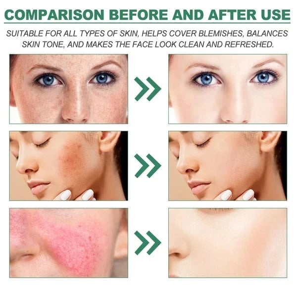 (🎉Last Day Promotion 50% OFF) Color Correcting Treatment Cream