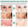 (🎉Last Day Promotion 50% OFF) Color Correcting Treatment Cream