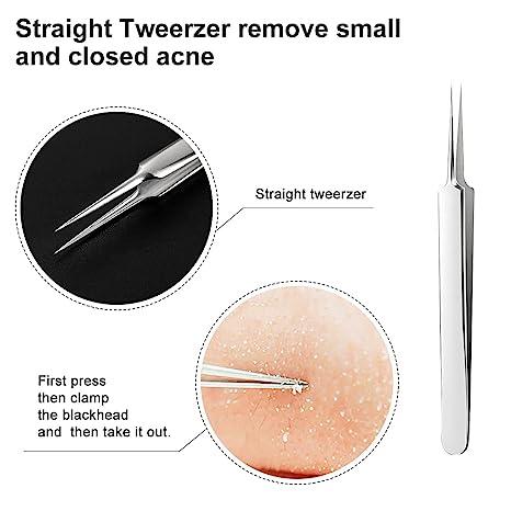 (⏰Last Day Promotion-60%OFF)Professional Facial Blackhead Remover Tweezers