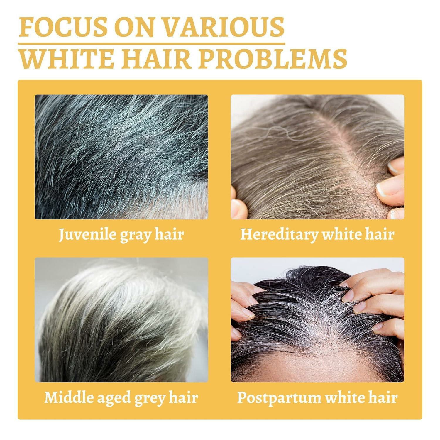 🔥Last Day Promotion- SAVE 70%🎄DARKA PRO Anti-Greying Hair Serum