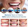 (🔥HOT SALE TODAY - 50% OFF)-Teeth Whitening Essence(buy 2 get 1 free)