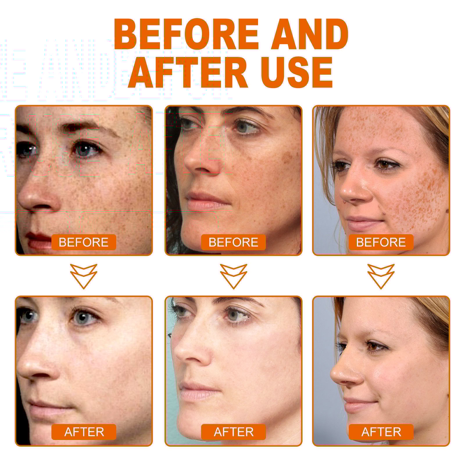 💥Daily Sales of 7200+🔥  2025 The Most Popular - Mature Women Whitening Skin Melanin Correcting Facial Serum