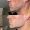 Dream Jawlines Made Real with THE JAW CHISEL BUNDLE PRO