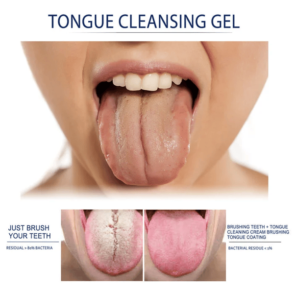 🔥2023New Year Sale -Probiotic Tongue Cleaning Gel Set(🔥Buy 4 get 4 Free & Free Shipping)