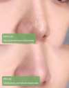 ✨Free shipping-Last Day 75% OFF 🔥-🍵 Deep Cleanse Green Tea Mask