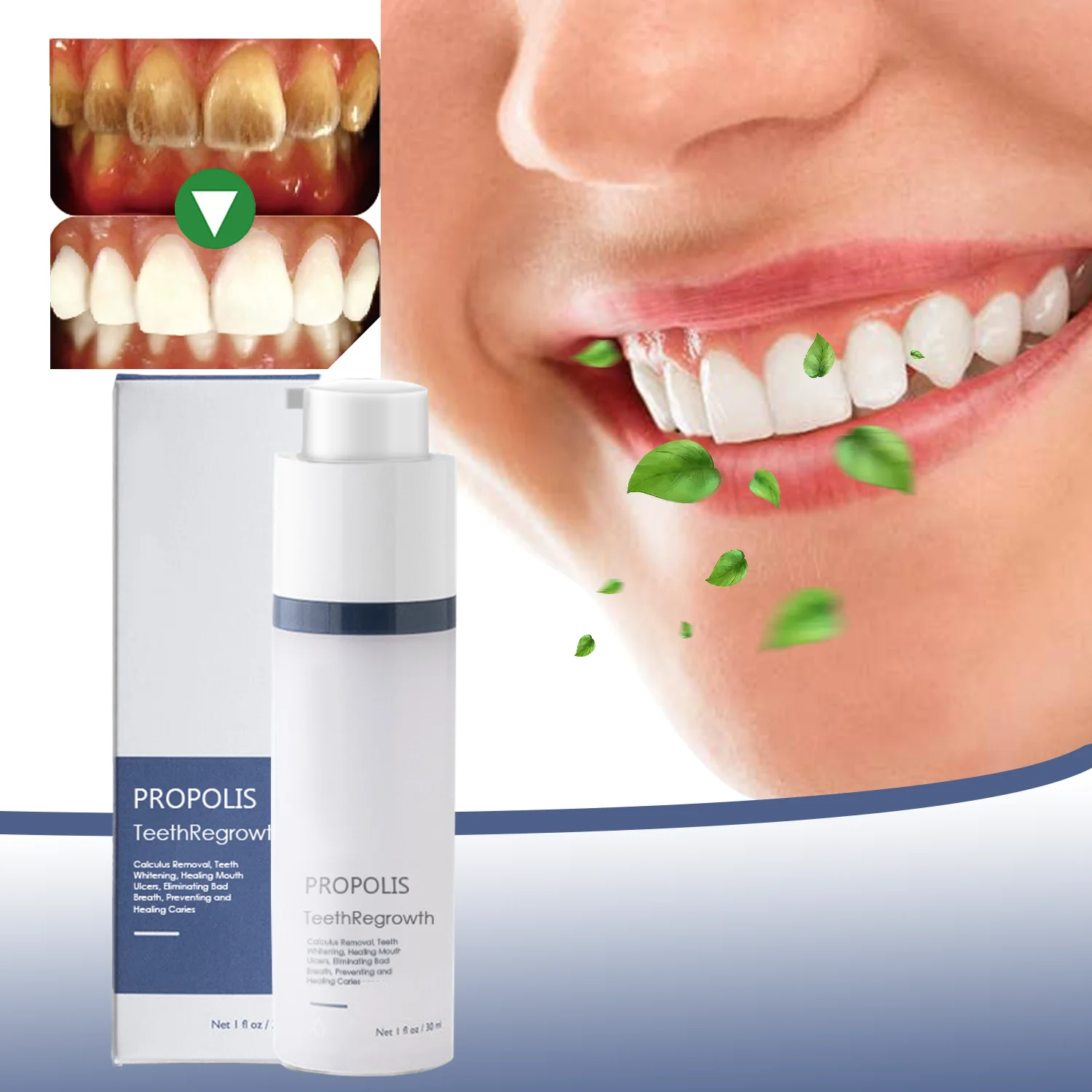 🔥Last Day Promotion-70% OFF-PROPOLIS Tooth Regeneration Gel (For all kinds of oral problems,especially teeth regeneration）