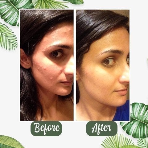 ✨Free shipping-Last Day 75% OFF 🔥-🍵 Deep Cleanse Green Tea Mask