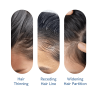 Advanced Hair Growth Roll-On Serum