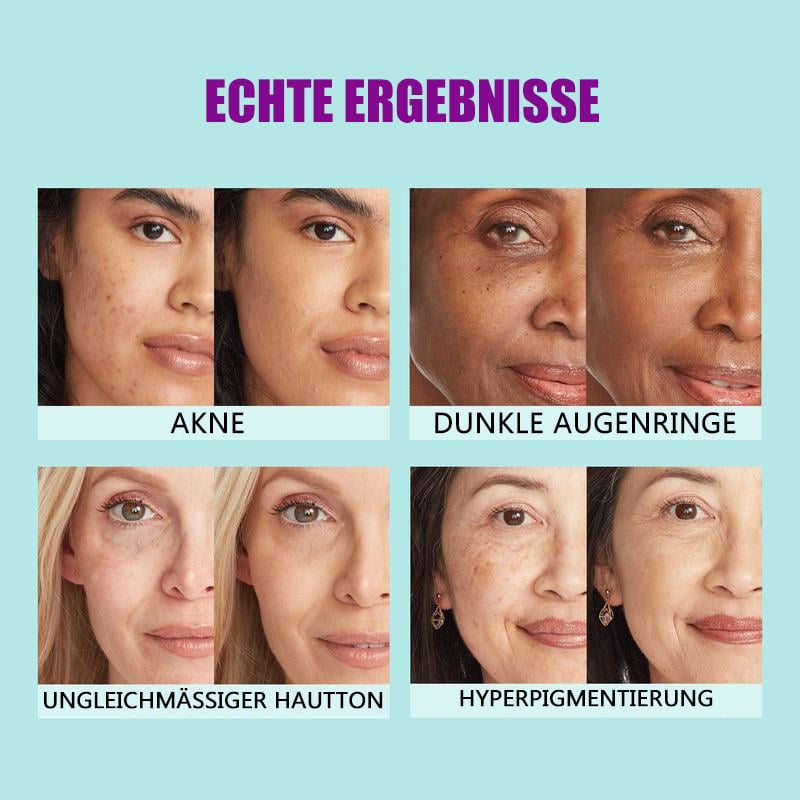 ✨All Over Complexion Perfector (💖Kaufen 2 und erhalten Make-up-Pinsel gratis!!)