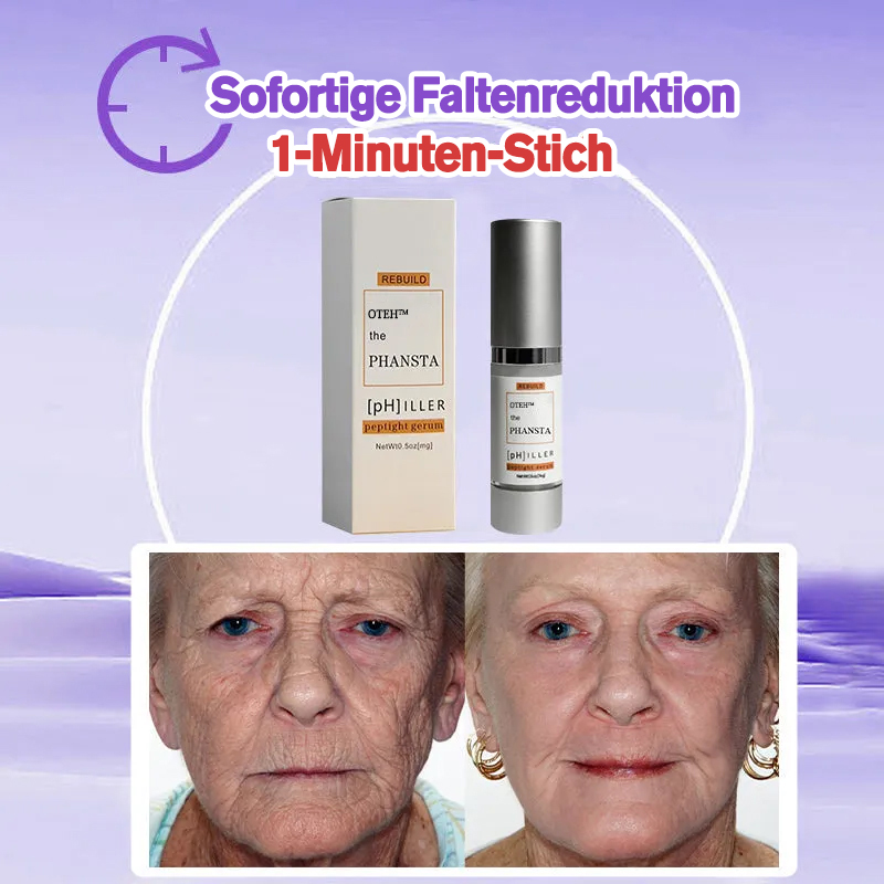 OTEH™-PEPTIDE Wrinkle Reducing Cream enthält 12 verschiedene Peptide (beseitigt Falten in 1 Minute)