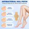 🔥LAST DAY ONLY 50% OFF🔥21 Pcs Fungal Nail Patches⚡BUY 3 GET 1 FREE