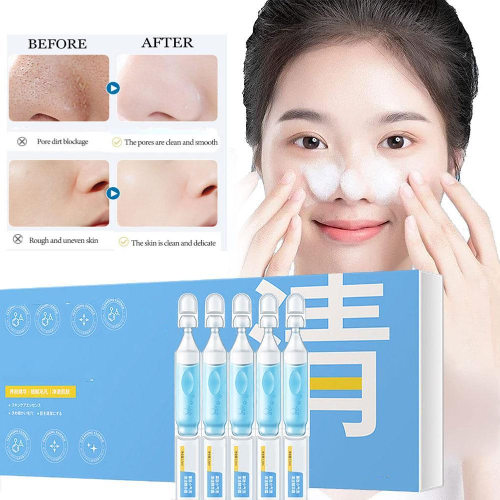 🔥Last Day Promotion 50% OFF🔥Tokyo Oligopeptide Small Bubble Cleaning Essence(10pcs)