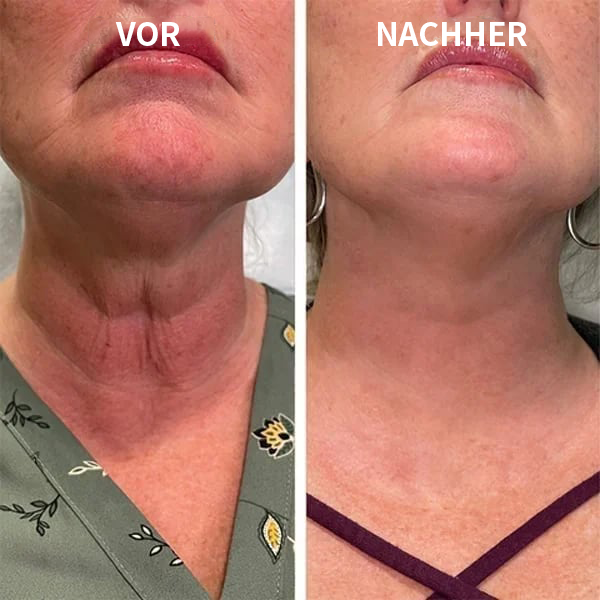 Aktion am letzten Tag: 49 % RABATT – 🔥Ardtadi® Botox-Gesichtsserum