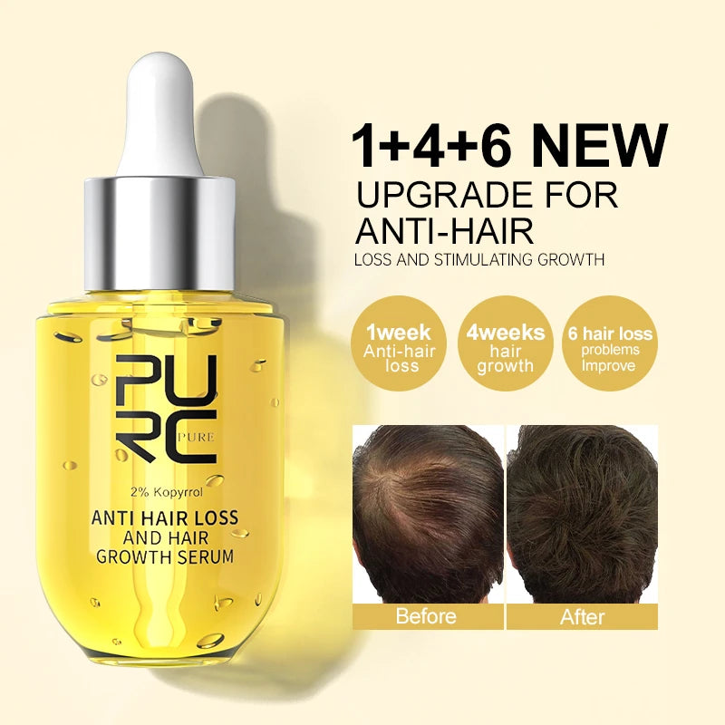 🔥Last Day 70% OFF - PURC Hair Growth Essential Oil