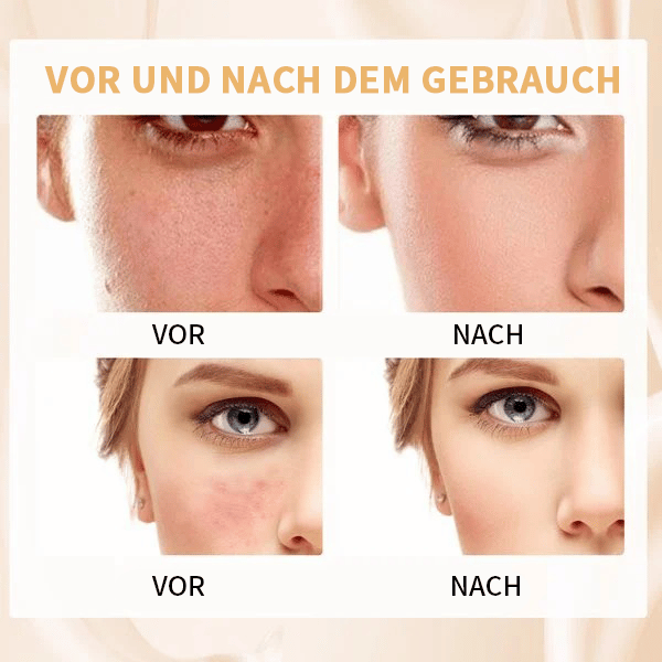 🔥KAUF 1 ERHALTE 1 GRATIS🔥Beste farbwechselnde Foundation für reife Haut