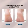🔥Mother's Day Sale-50% OFF🎁Rechargeable Electric Foot Callus Remover