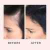 🔥Last Day Promotion 50% OFF🔥Hair Growth Serum