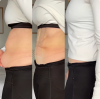 BUY MORE SAVE MORE!!!-- Invisible Patches