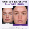 BENDCHARGE™ PigmentaX ProFade Anti-Hyperpigmentation Cream