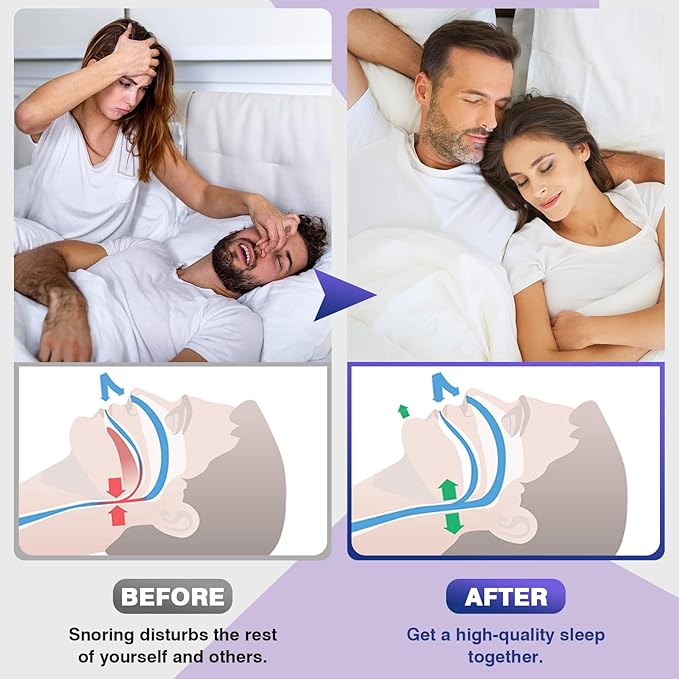 💤 Anti Snoring Devices Set